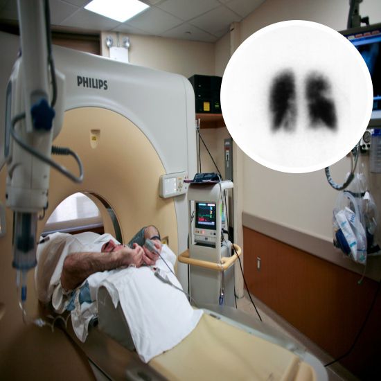 lung ventilation scan